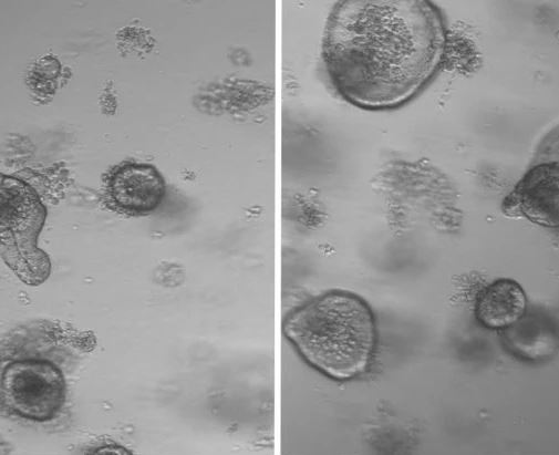 Study on how Fasting boosts stem cells’ regenerative capacity